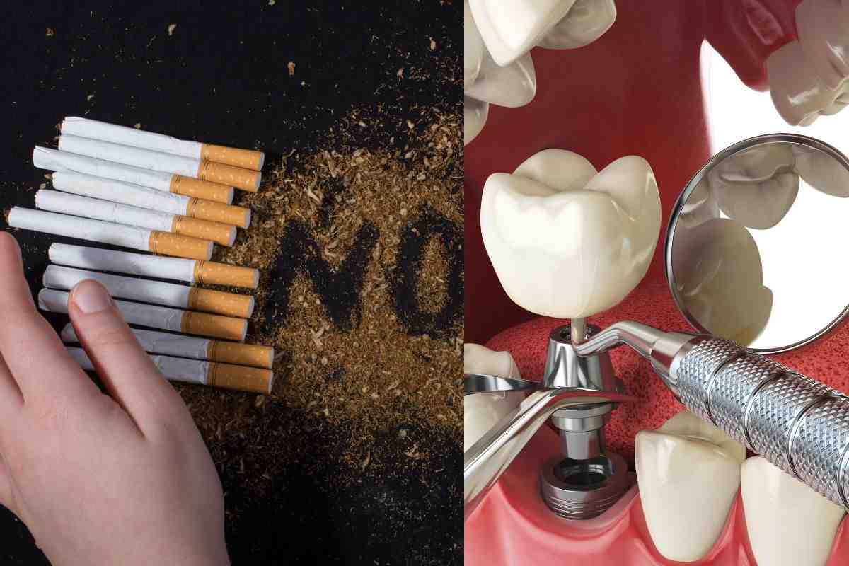 tabaco dientes implantes salud dental