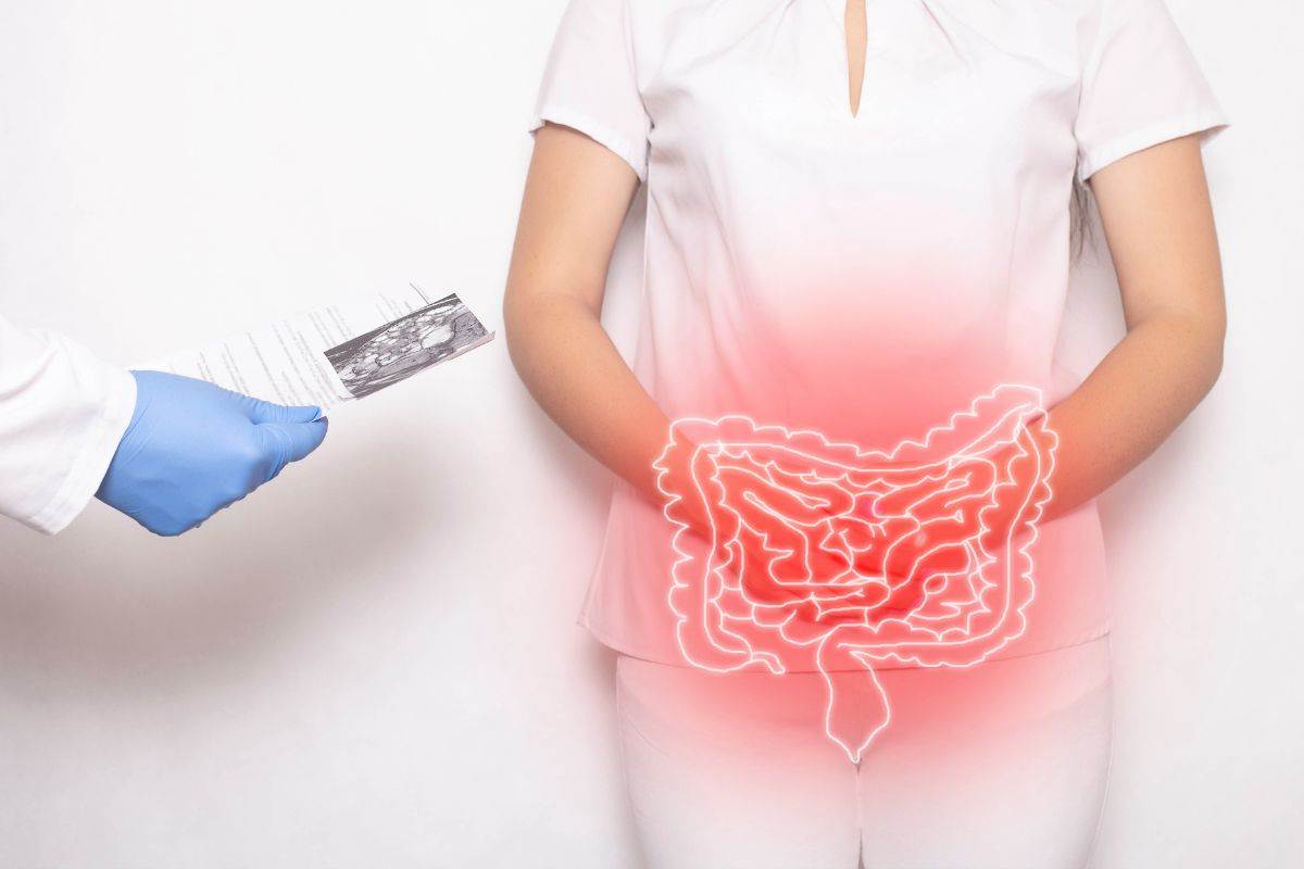 Evita padecer diverticulitis, te explicamos en qué consiste