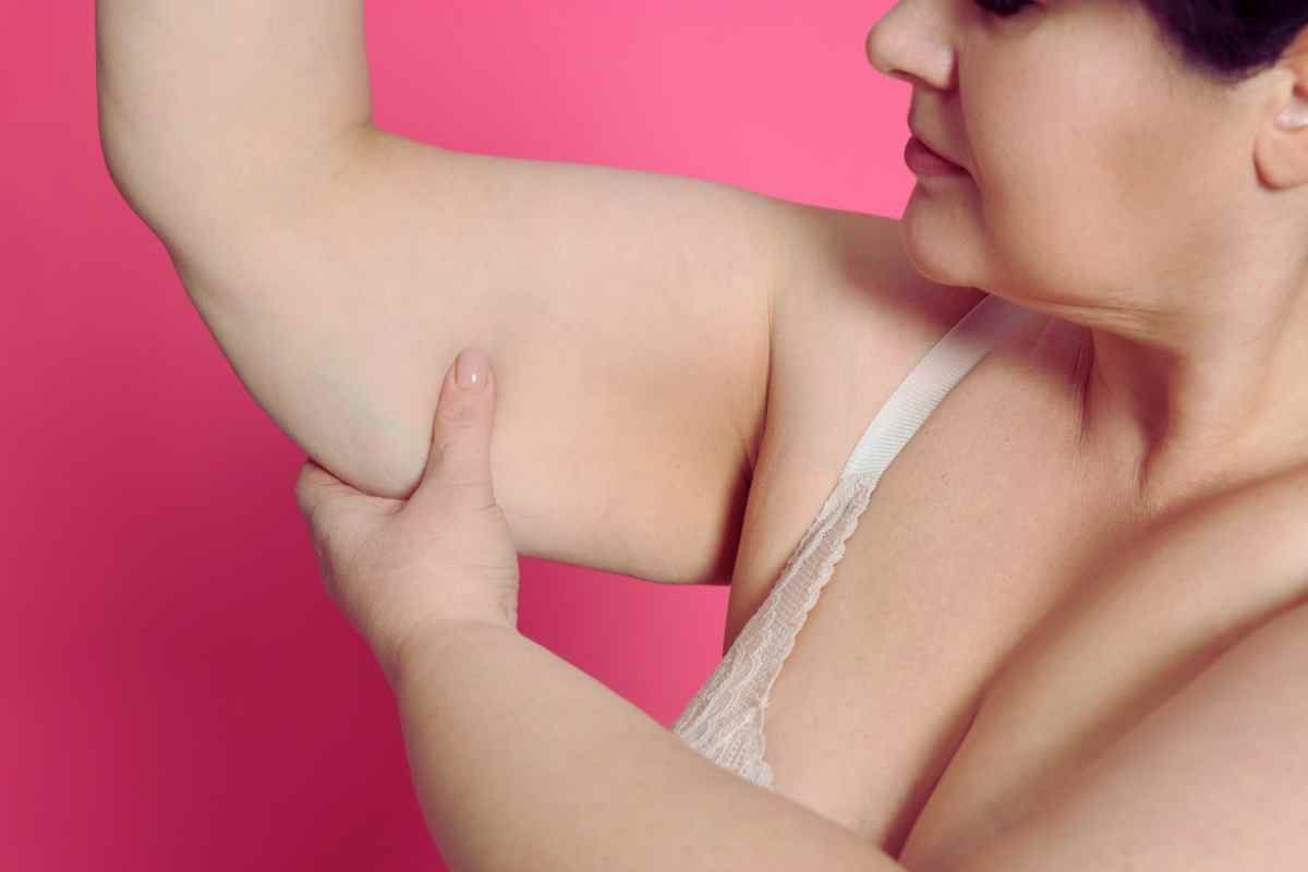 donna che si tocca le braccia flaccide