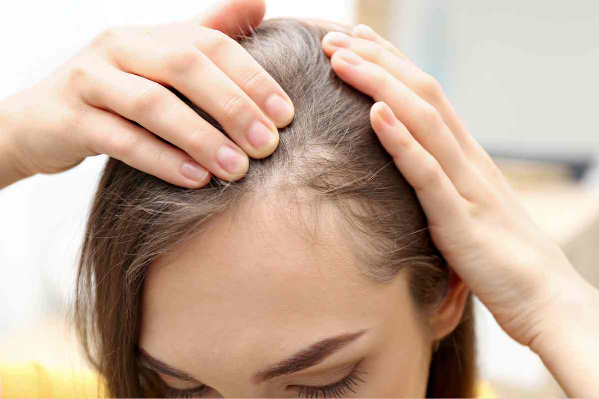 adelgazamiento del cabello <br srcset=