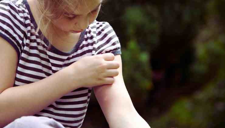 La niña se rasca el brazo