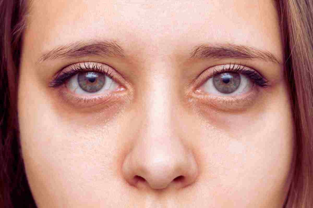 rostro de mujer con ojeras